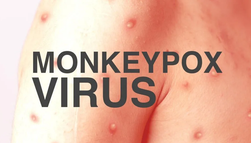 Monkeypox virus - tác nhân gây nên bệnh đậu mùa khỉ