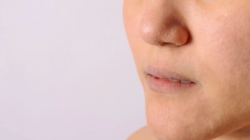 Da mặt ngứa, sần sùi có thể do tác động từ bên ngoài hoặc bệnh lý