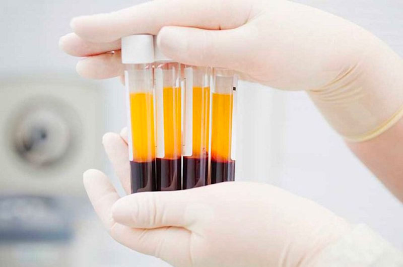 Xét nghiệm máu, tìm kháng thể là một trong những phương pháp chẩn đoán