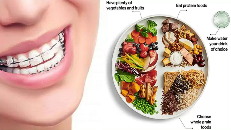 Chế độ ăn uống có vai trò lớn đối với việc mang lại cảm giác thoải mái và hiệu quả đạt được khi niềng răng