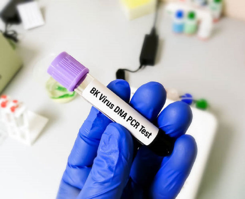 Xét nghiệm Real time PCR BK giúp kiểm tra định lượng virus trong cơ thể