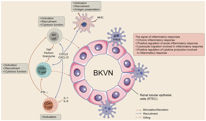 BKV thường hoạt động mạnh trong cơ thể bệnh nhân mới ghép thận