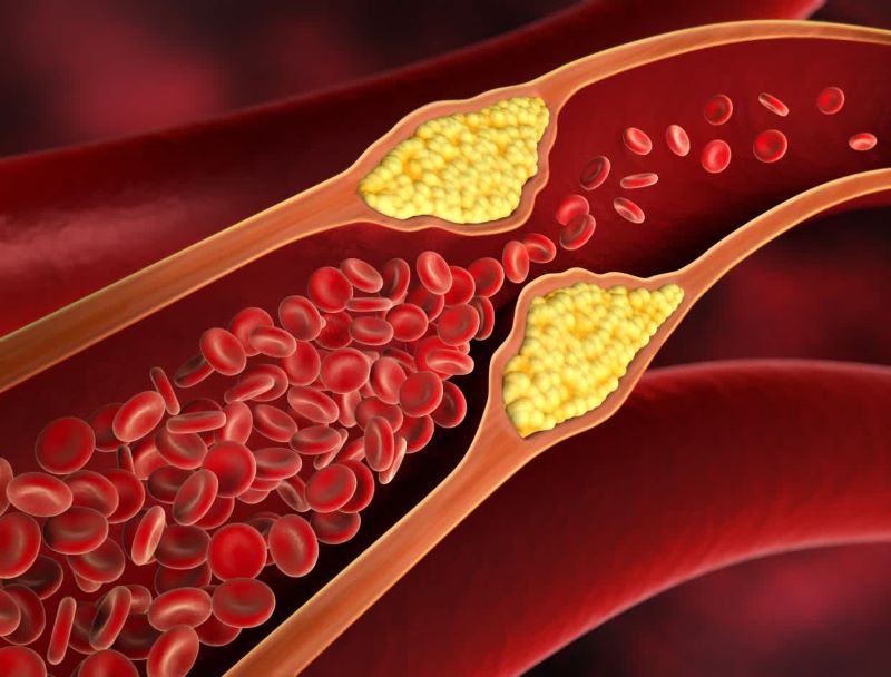 Vitamin B3 giúp giảm Cholesterol xấu trong máu, ngăn ngừa bệnh tim mạch