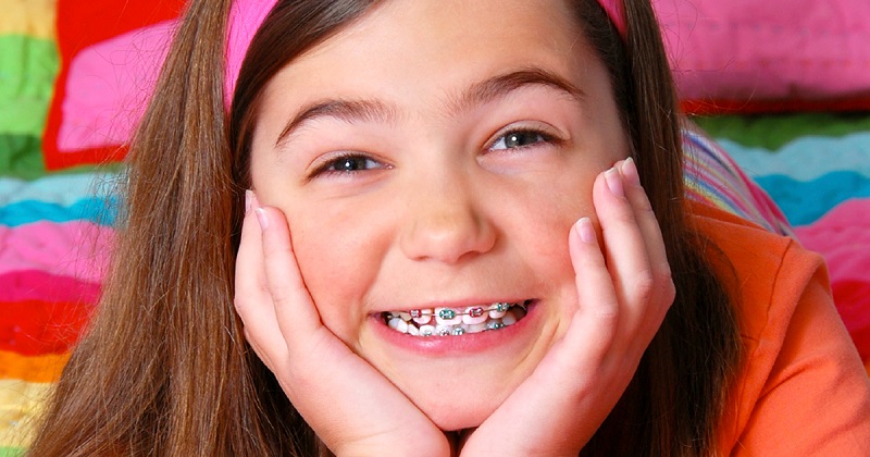 Niềng răng cho trẻ càng sớm thì điều chỉnh vị trí răng càng dễ, hiệu quả thẩm mỹ càng cao 