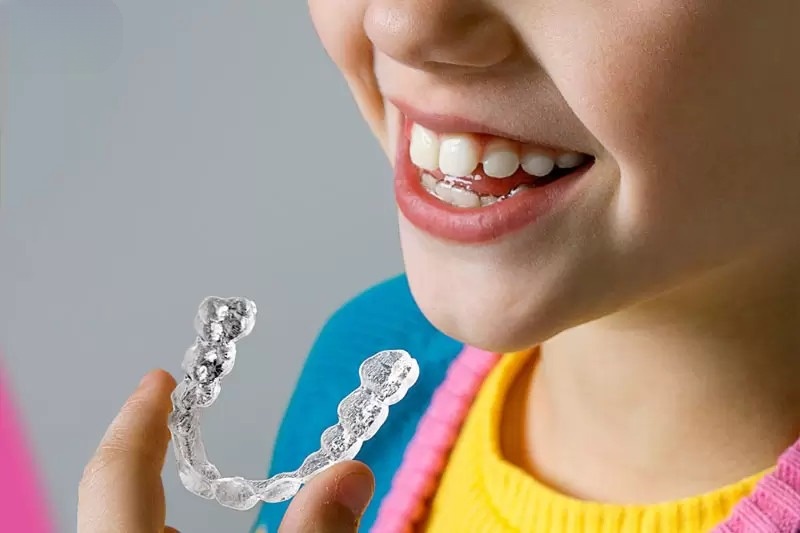 Niềng răng cho trẻ bằng khay niềng trong suốt Invisalign giúp trẻ dễ dàng tháo lắp để vệ sinh răng miệng