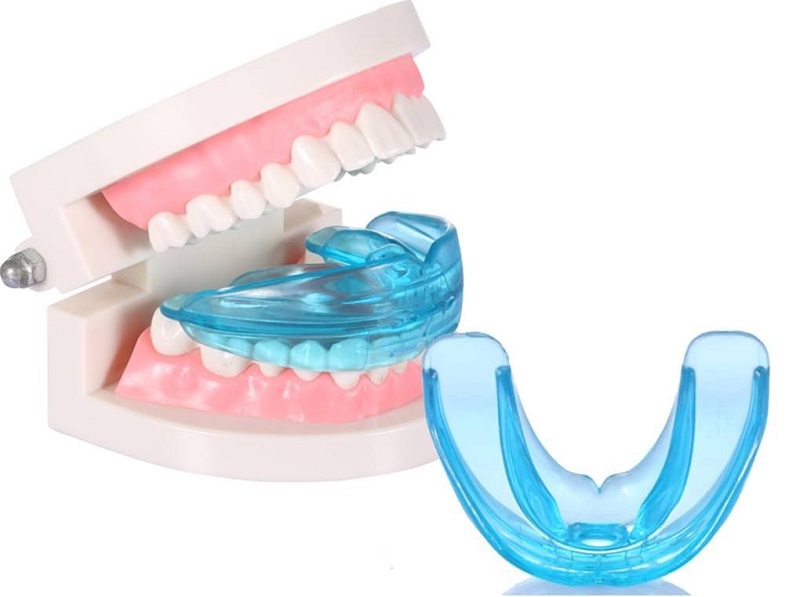 Bộ niềng răng tại nhà hàm trainer đang được nhiều người lựa chọn để sử dụng cho trẻ nhỏ