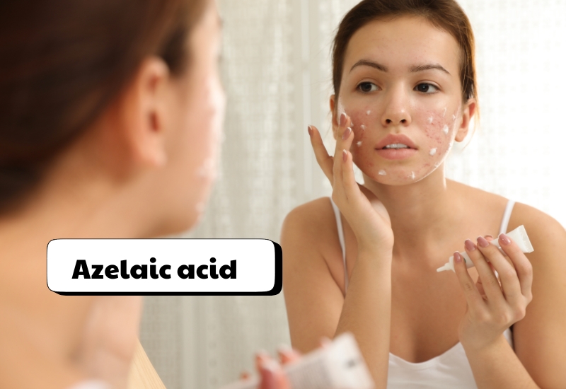 Azelaic acid điều trị các vấn đề về da mụn, thâm nám