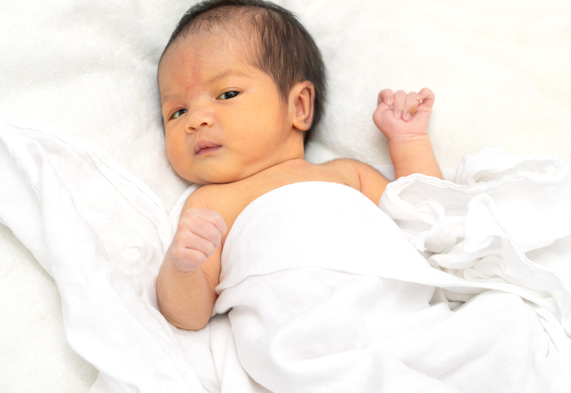 Vàng da ở trẻ sơ sinh thường là lành tính, không nguy hiểm