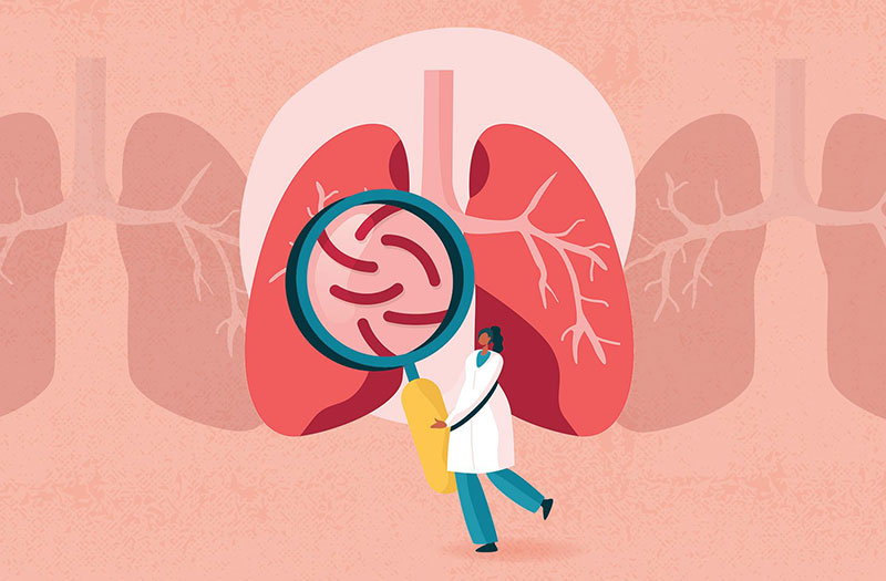 Triệu chứng và dấu hiệu nhận biết đã bị bệnh lao phổi là gì?
