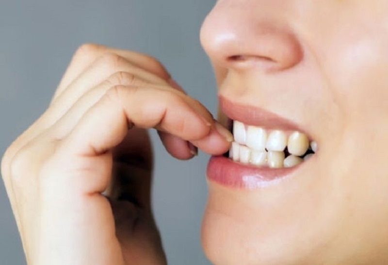 Dùng tay đẩy răng vào bên trong là một cách chữa răng hô nhẹ không cần niềng có thể áp dụng tạm thời tại nhà