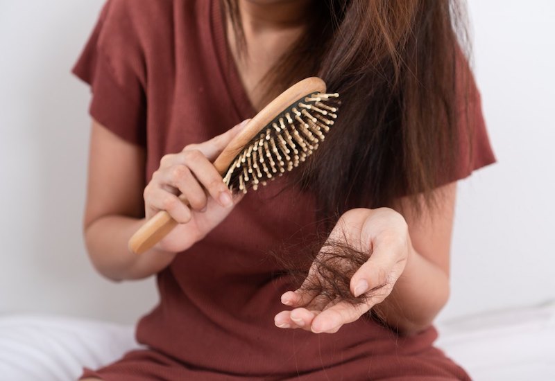 Tóc rụng nhiều có là triệu chứng của bệnh lão hóa không?
