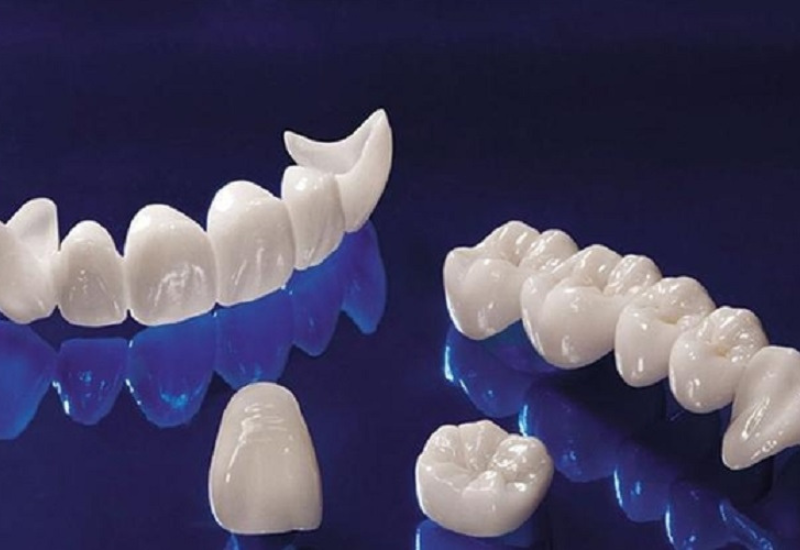 Răng toàn sứ có giá thành cao hơn so với một số loại răng sứ khác