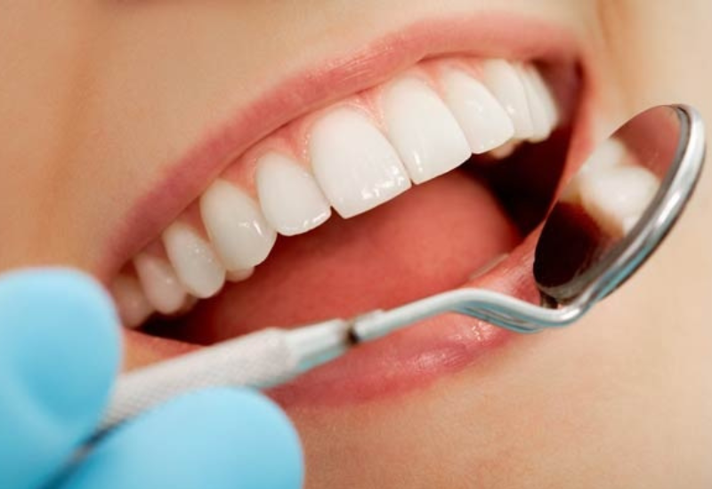 Lấy tủy bọc răng sứ giá bao nhiêu phụ thuộc vào nhiều yếu tố