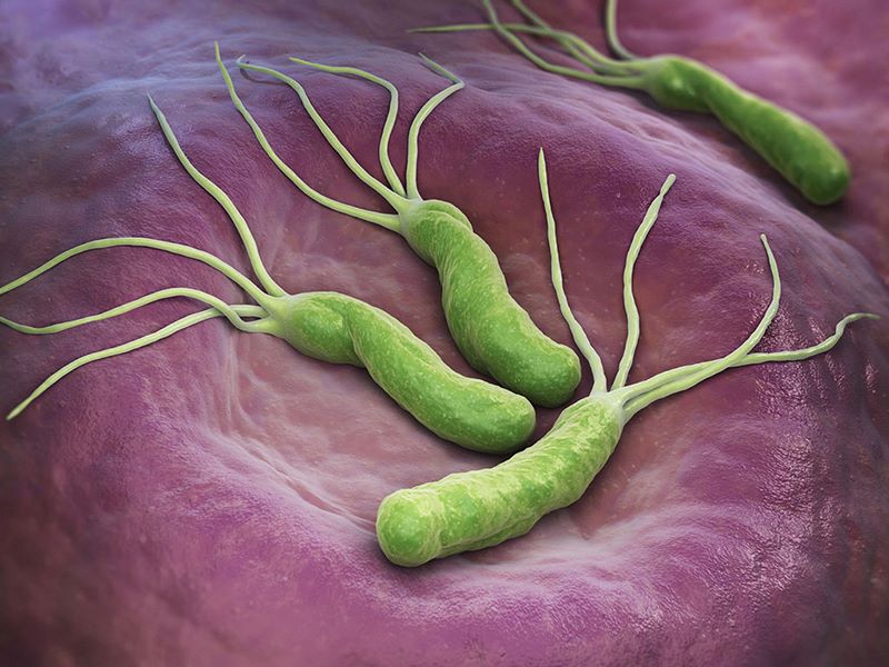 Helicobacter Pylori (vi khuẩn HP) là nguyên nhân gây ra các bệnh lý dạ dày nghiêm trọng  