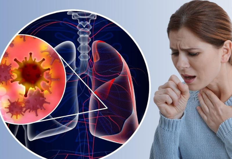 Ho là triệu chứng phổ biến của bệnh lao phổi