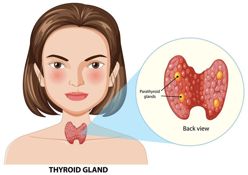 Bướu giáp nhân thùy phải là tình trạng bướu phải xuất hiện nhiều u bướu lớn 