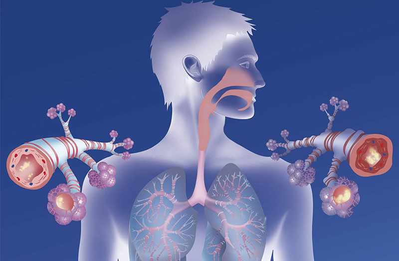 Bệnh hen suyễn có thể gây ra những triệu chứng gì?
