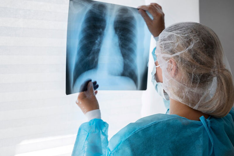 Các phương pháp chẩn đoán hình ảnh được dùng để chẩn đoán bệnh hen suyễn