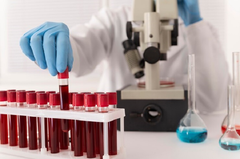 Chỉ số PCT trong xét nghiệm máu có ý nghĩa đánh giá nhiễm khuẩn