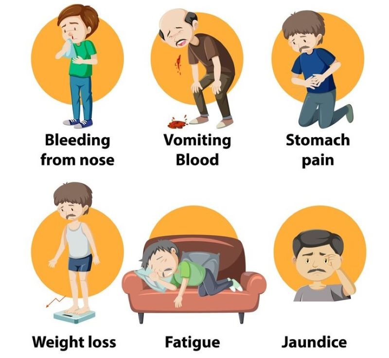 Những triệu chứng phổ biến khi bị xơ gan