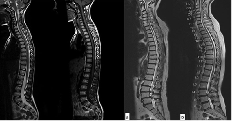 Cân nhắc lựa chọn cơ sở y tế uy tín để thực hiện kỹ thuật chụp MRI cột sống thắt lưng 