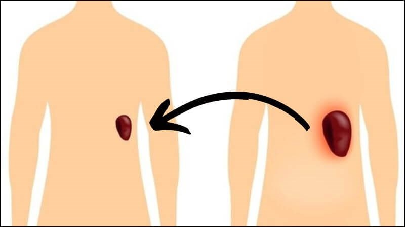 Lá lách to có nguy hiểm không là thắc mắc nhiều người đặt ra 