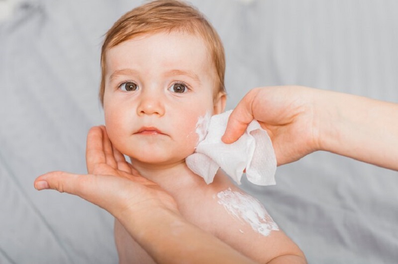 Cấu trúc da của trẻ sơ sinh còn mỏng manh nên cần được chăm sóc cẩn thận