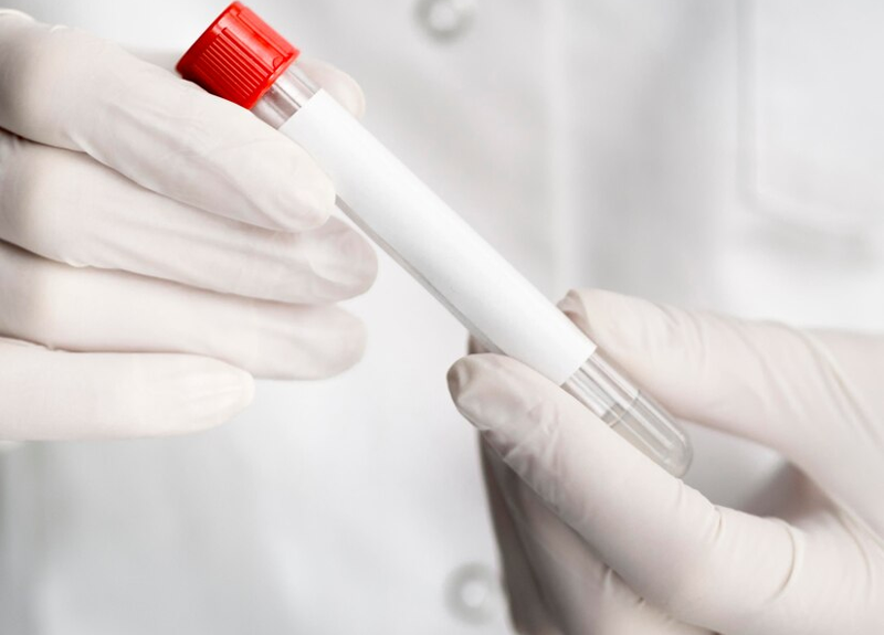 Phương pháp xét nghiệm HPV ở nam giới hiện nay chưa nhiều và phổ biến như ở nữ giới 