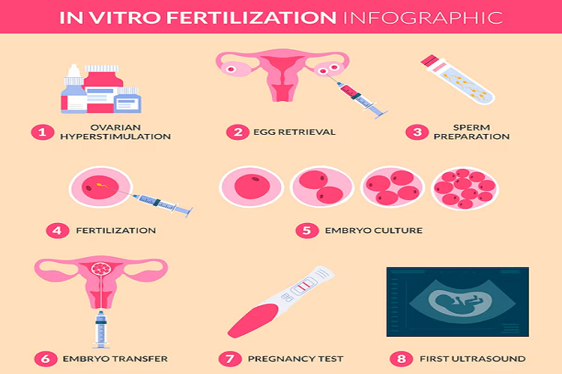 Hình ảnh khái quát các bước của quy trình thụ tinh bằng IVF