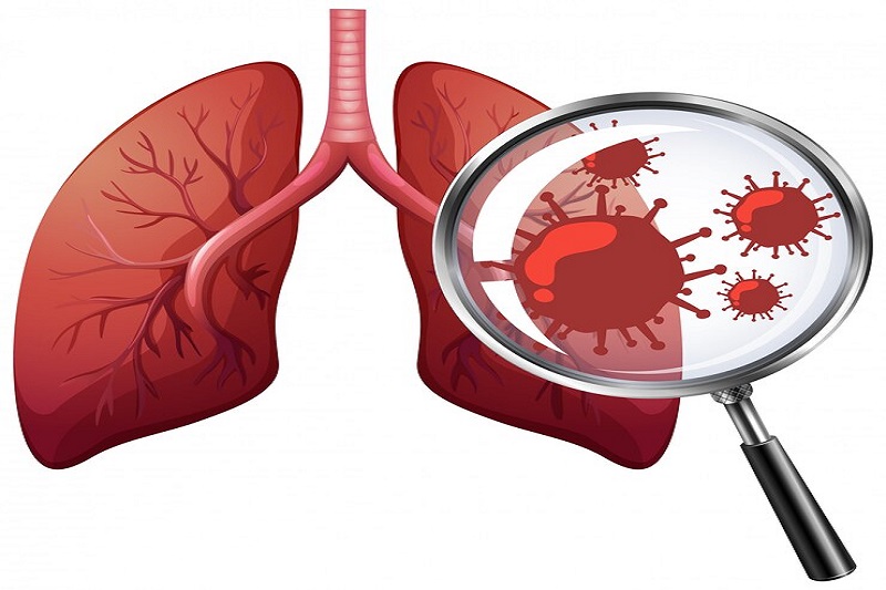 Trẻ có thể bị biến chứng viêm phổi nếu không được điều trị sốt mò kịp thời