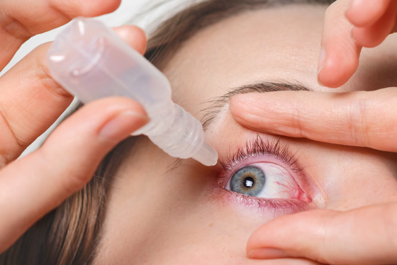 Không dùng chung thuốc nhỏ mắt, đặc biệt là thuốc nhỏ mắt của người bệnh