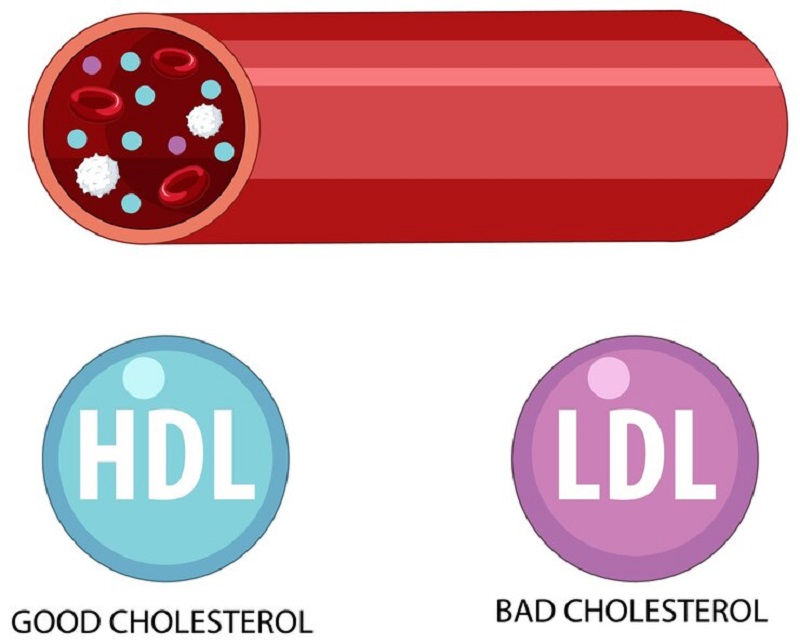 HDL-C và LDL-C là 2 cholesterol trong máu có giá trị phản ánh bệnh lý tim mạch