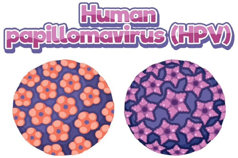 Sự phát triển của một số chủng virus HPV dễ dẫn đến ung thư dương vật