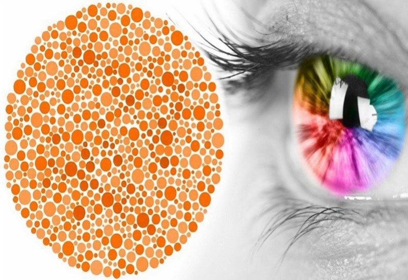 Bệnh mù màu là bệnh lý có khả năng di truyền 