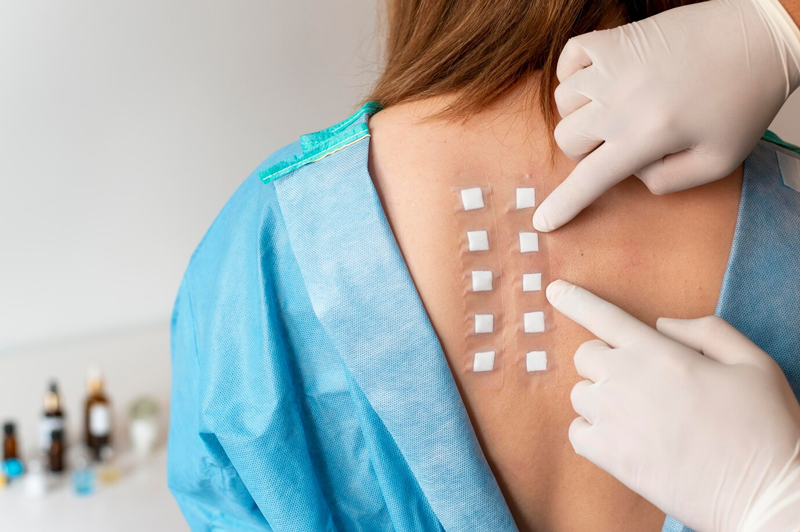 Test áp bì được thực hiện chủ yếu trên vùng da lưng 
