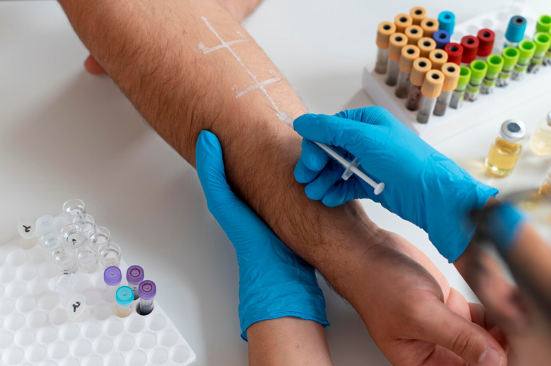 Kết quả của test da giúp phát hiện dị ứng phụ thuộc vào nhiều yếu tố 
