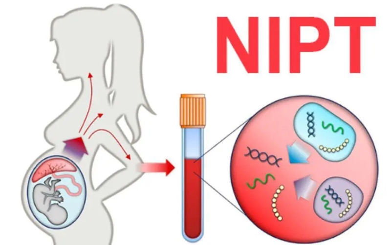 NIPT là phương pháp sàng lọc dị tật thai nhi mang lại nhiều ưu điểm vượt trội 