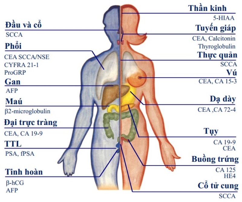 Xét nghiệm dấu ấn ung thư đóng vai trò quan trọng trong việc tầm soát ung thư 