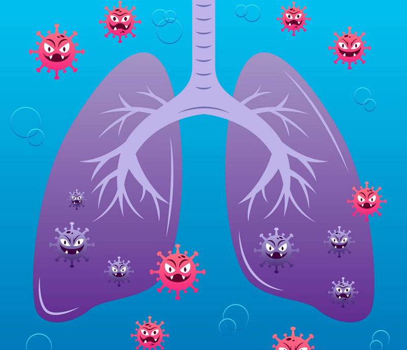 Người bị viêm phổi do virus, vi khuẩn hoặc nấm có thể bị ho ra đờm vàng