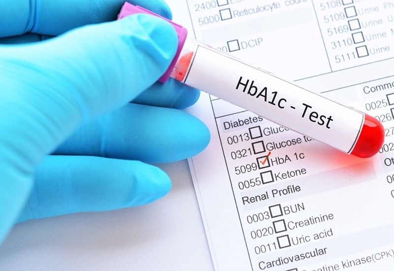 Xét nghiệm HbA1c đánh giá mức độ kiểm soát bệnh tiểu đường dài hạn