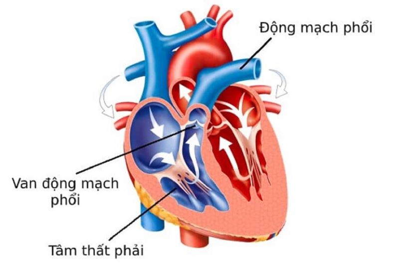 Van động mạch phổi mở, máu bơm một chiều từ tâm thất phải vào động mạch chủ