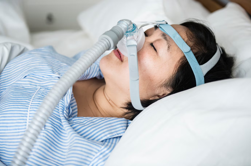 Người bệnh đeo máy thở áp lực dương liên tục (CPAP) để hỗ trợ đường thở 