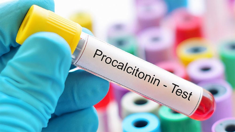 Xét nghiệm Procalcitonin mang lại nhiều giá trị trong chẩn đoán và điều trị tình trạng nhiễm khuẩn đường hô hấp dưới 