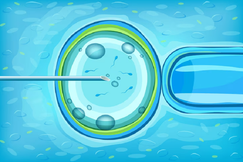 Thụ tinh trong ống nghiệm có khả năng mang thai song sinh cao