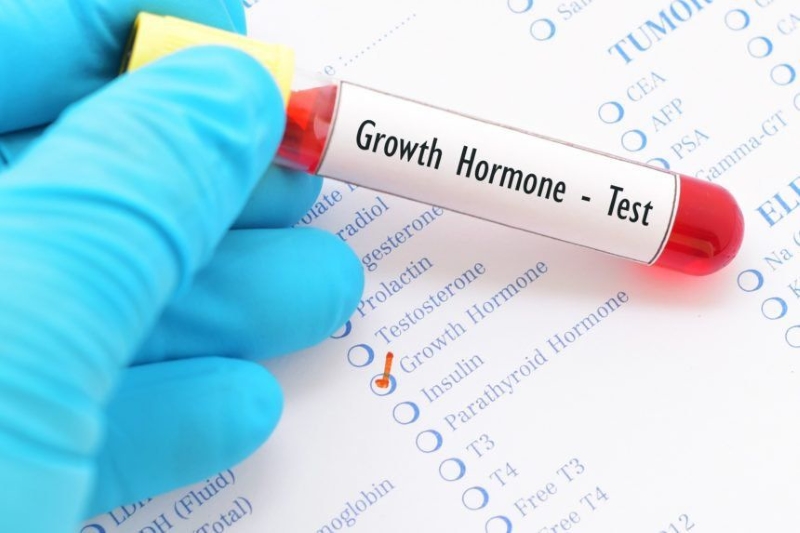 Hormone tăng trưởng đóng vai trò quan trọng đối với sức khỏe 