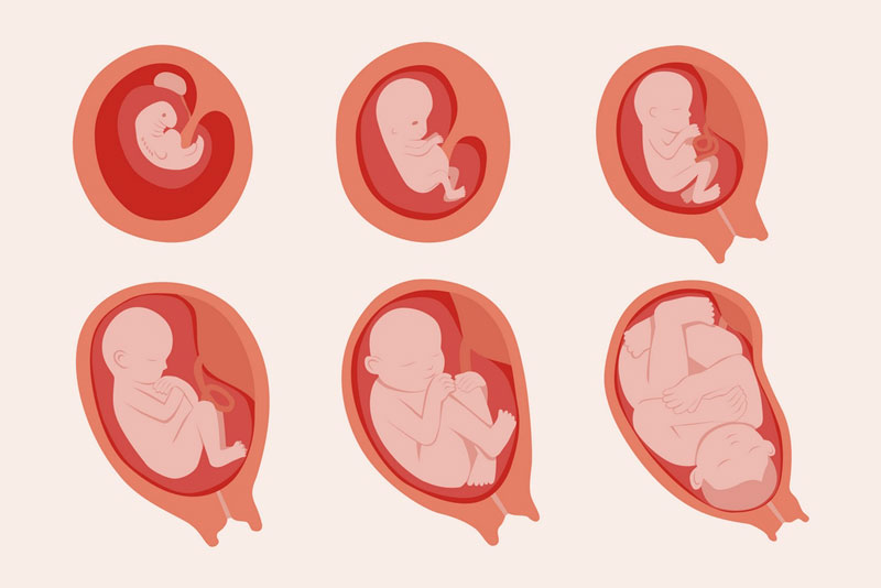 Xét nghiệm NIPT giúp xác định nhiều dị tật thai nhi có rủi ro gặp phải