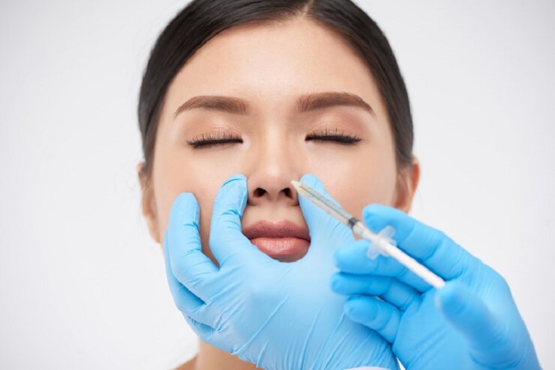 Tiêm Filler giúp cải thiện dáng mũi lõm