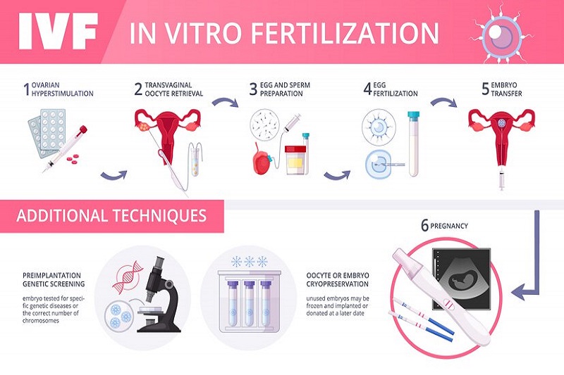 Thực hiện IVF là một trong các trường hợp cần lấy tinh trùng ở nam giới