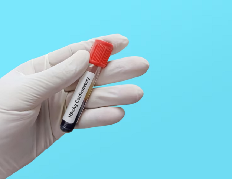 Xét nghiệm HBsAg giúp xác định sự hiện diện của virus viêm gan B trong máu