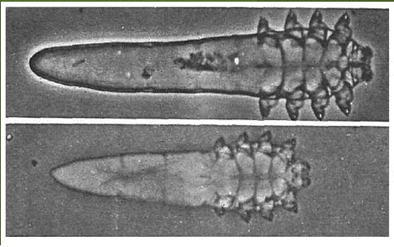 Demodex là loài ký sinh trùng trên da, nang lông, bã nhờn của con người